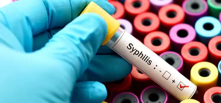 Aumentan casos de sífilis en el estado
